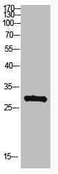 MYOZ2 Antibody