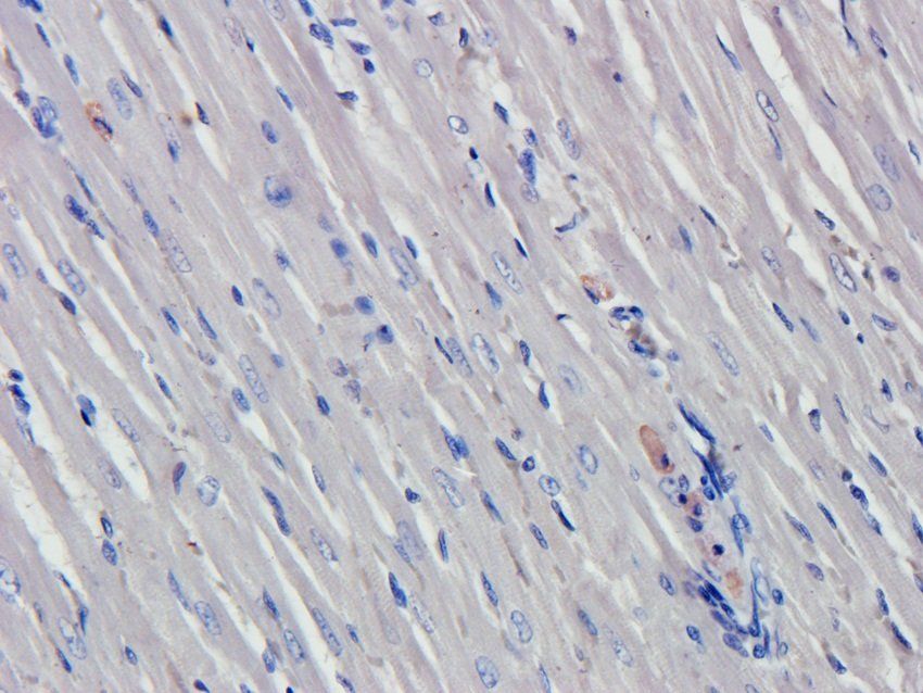 N Cadherin antibody