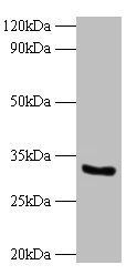 CYB5R3 Antibody