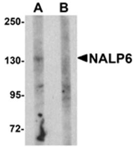 NALP6 Rabbit Polyclonal Antibody