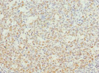 NASP Antibody