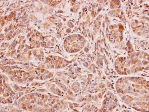 NAT2 Rabbit Polyclonal Antibody