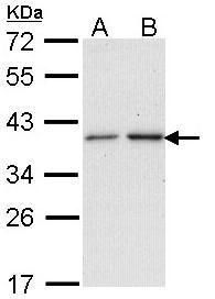 NAT2 Rabbit Polyclonal Antibody