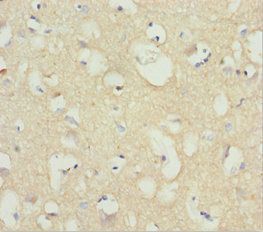 NCALD Antibody