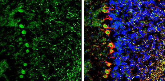 NCKAP1 Rabbit Polyclonal Antibody