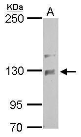 NCKAP1 Rabbit Polyclonal Antibody