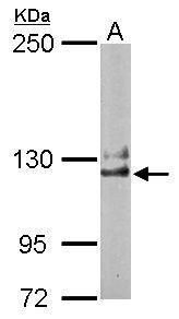 NCKAP1 Rabbit Polyclonal Antibody