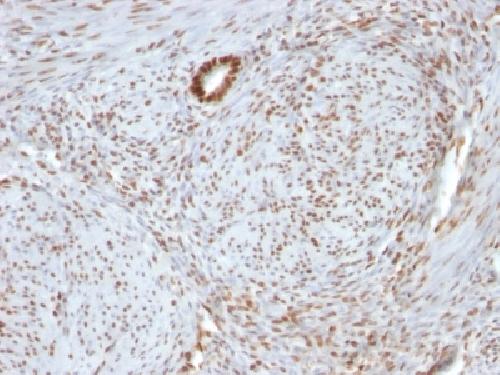 NCL Antibody