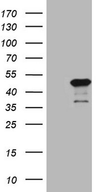 NCOA2 Antibody