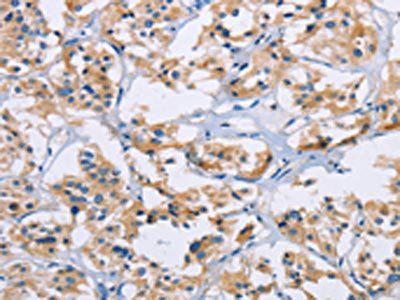 NCR3 Antibody