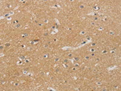 NDRG1 Antibody