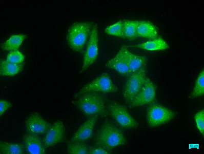 NDRG1 Antibody