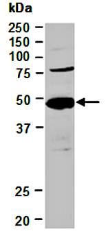 NDRG1 (M) Antibody, Rabbit Polyclonal