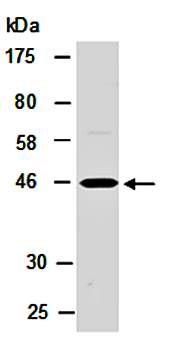 NDRG1 (C) Antibody, Rabbit Polyclonal