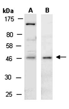 NDRG1 (vPairTM) Antibodies
