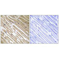 NDRG4 Antibody