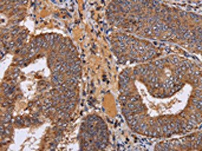 NDUFA1 Antibody