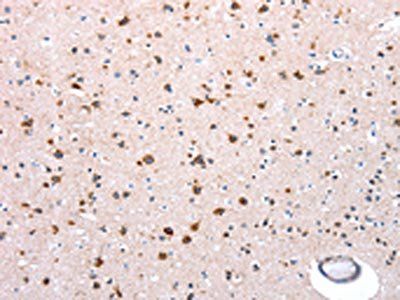 NDUFA12 Antibody