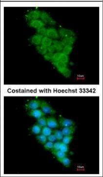 NDUFA12 Rabbit Polyclonal Antibody