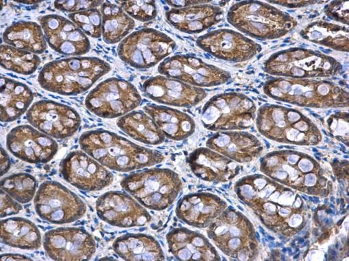 NDUFA12 Rabbit Polyclonal Antibody