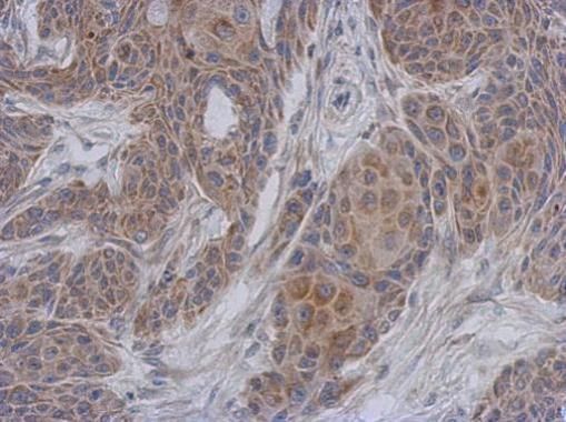NDUFA12 Rabbit Polyclonal Antibody