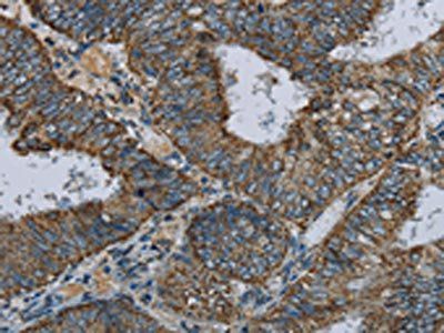 NDUFA5 Antibody