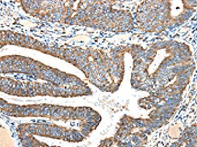 NDUFA5 Antibody