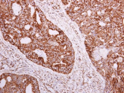 NDUFA5 Rabbit Polyclonal Antibody