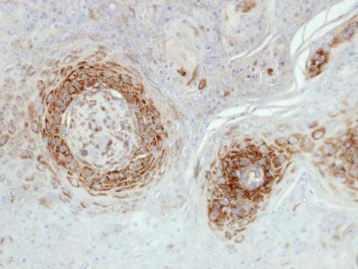 NDUFA5 Rabbit Polyclonal Antibody