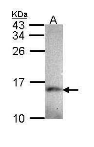 NDUFA5 Rabbit Polyclonal Antibody