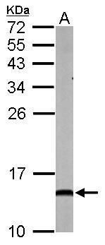NDUFA5 Rabbit Polyclonal Antibody