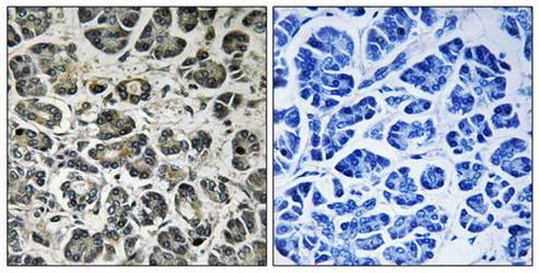 NDUFA8 Antibody