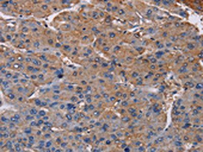 NDUFA9 Antibody