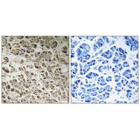 NDUFB1 Antibody