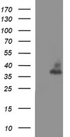NDUFB10 Antibody
