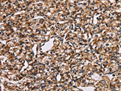 NDUFS1 Antibody
