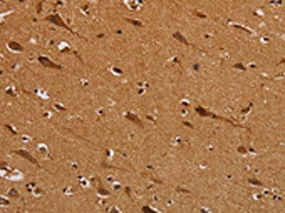 NDUFS5 Antibody