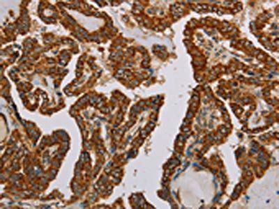 NDUFS5 Antibody