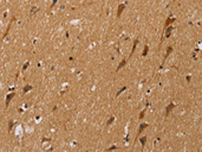 NDUFS5 Antibody