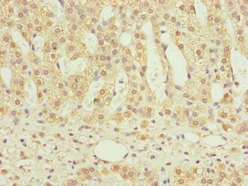 NDUFS6 Antibody