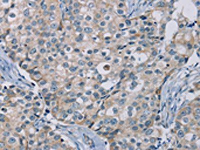 NDUFS7 Antibody