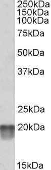 NDUFS7 Antibody