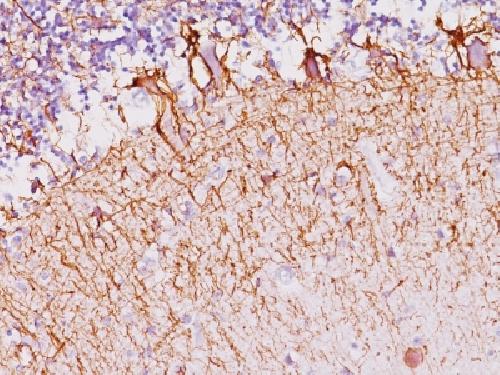 NEFH Antibody