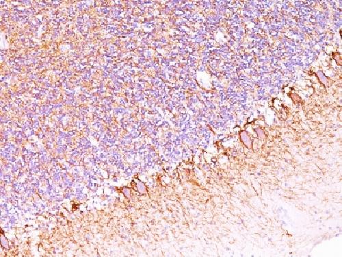 NEFH Antibody