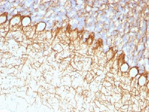 NEFH Antibody