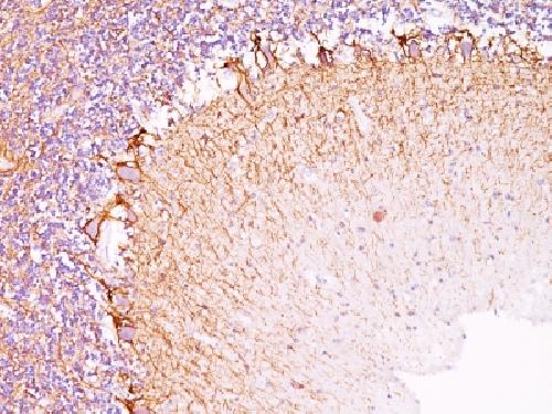 NEFH Antibody