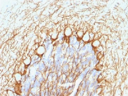 NEFH Antibody