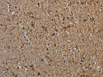 NEFH Antibody