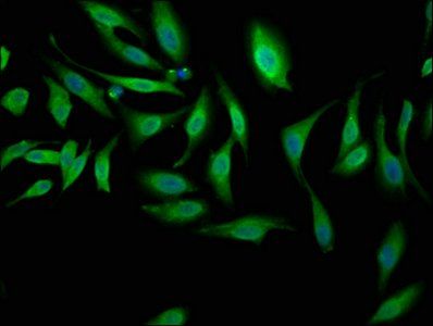 NEK1 Antibody
