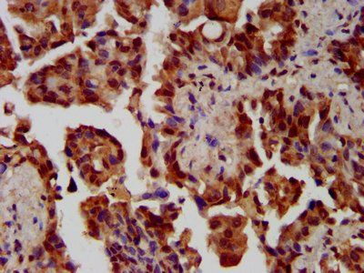 NEK1 Antibody
